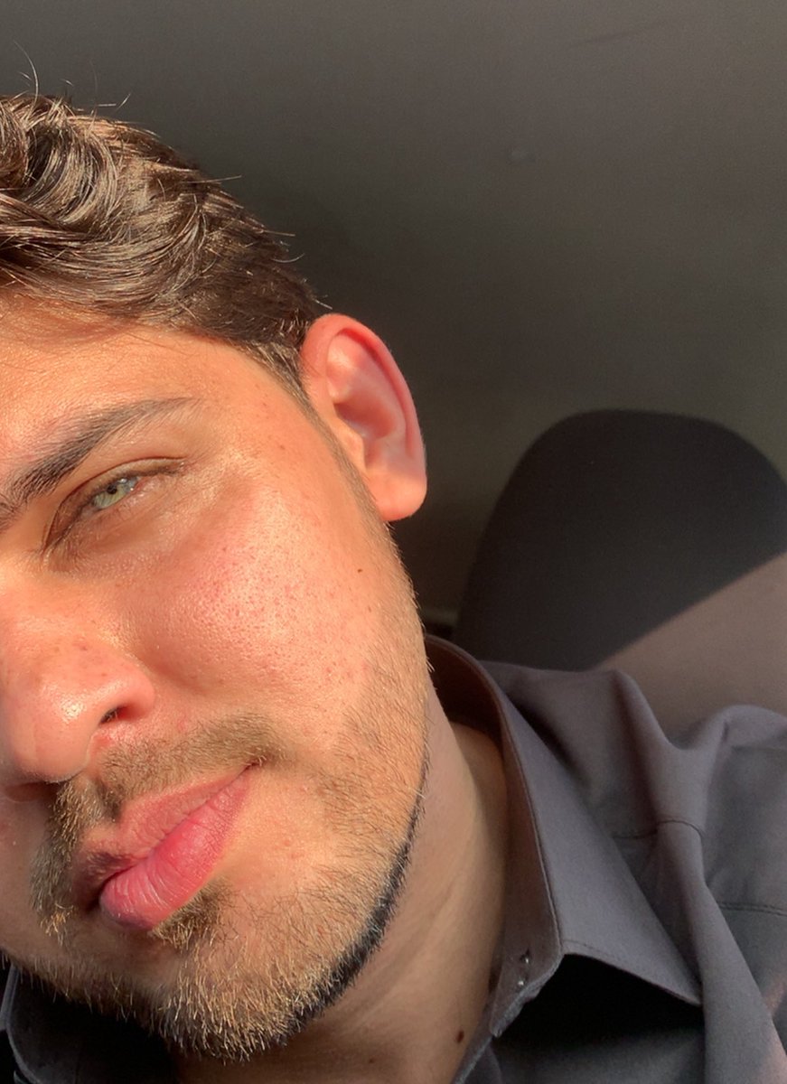 Mtbionic's tweet photo. @Idledhemledhpeh Mean while me when sun is out with no filter https://t.co/Fp7fd7Xlvo