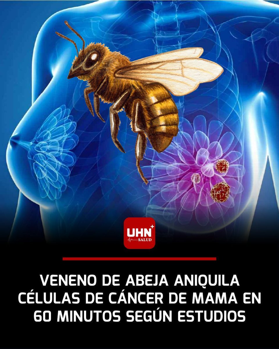 UHN_Plus_Salud's tweet image. 🩺🇦🇺‼️ | El veneno de abejas melíferas europeas, rico en la molécula melitina, destruye completamente células agresivas de cáncer de mama triple negativo y HER2-enriquecido en pruebas de laboratorio, perforando sus membranas en solo 60 minutos con un 100% de mortalidad celular…