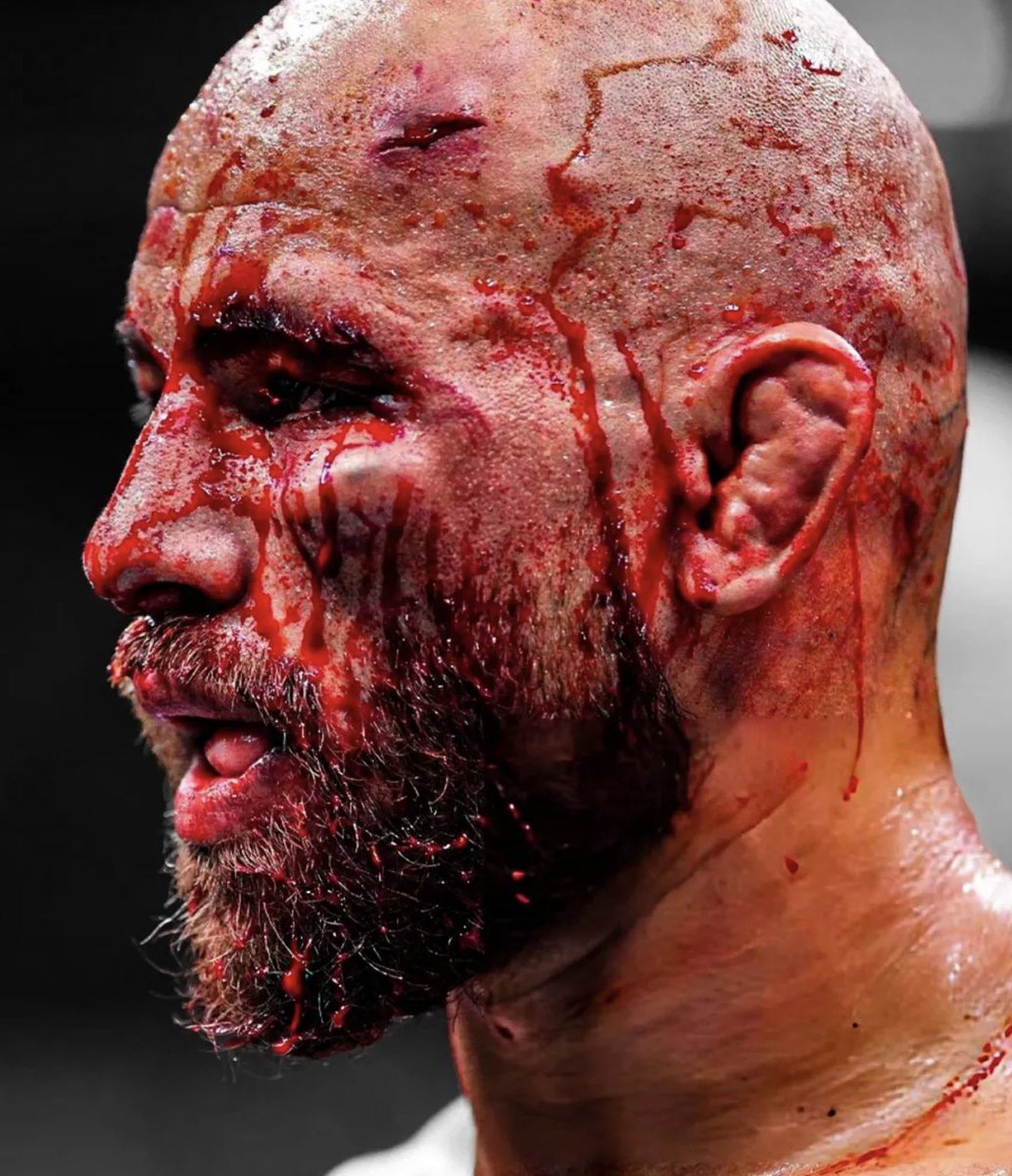 Diego Lopes deserves no hate btw

don’t forget that he put on one of the best “you’re not him yet pal” performances of the year so far