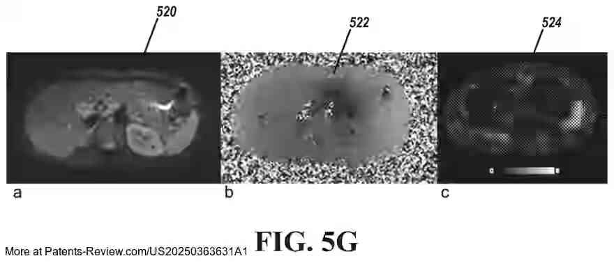 PatentPulse's tweet image. 🔍 New patent application #US20250363631A1 by #IcahnSchoolOfMedicine reveals a #DeepLearning-based system for enhancing #MagneticResonanceElastography (MRE) data acquisition. 
  
This innovation aims to automate quality control and stiffness measurements, minimizing…