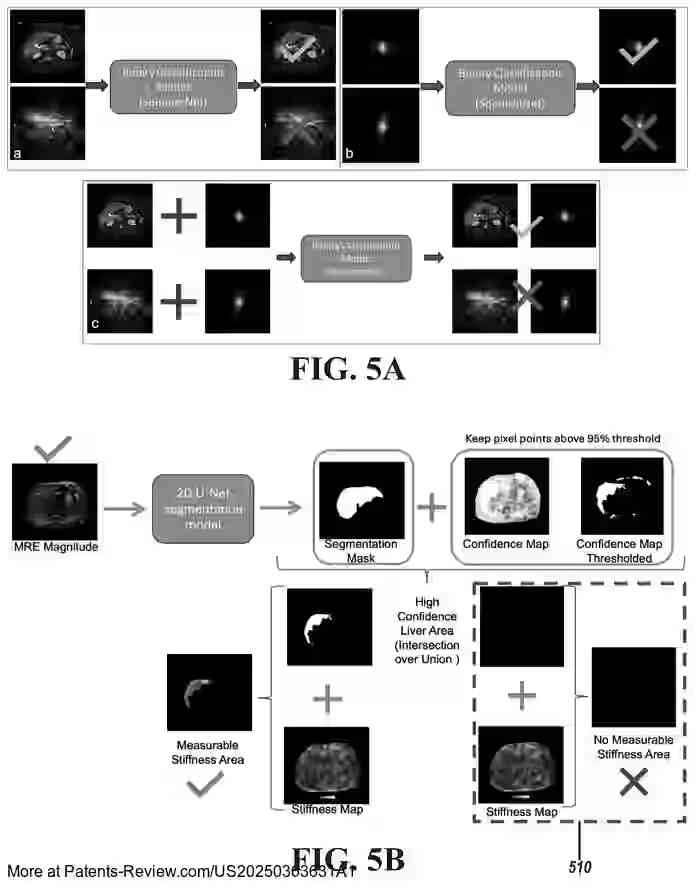 PatentPulse's tweet image. 🔍 New patent application #US20250363631A1 by #IcahnSchoolOfMedicine reveals a #DeepLearning-based system for enhancing #MagneticResonanceElastography (MRE) data acquisition. 
  
This innovation aims to automate quality control and stiffness measurements, minimizing…