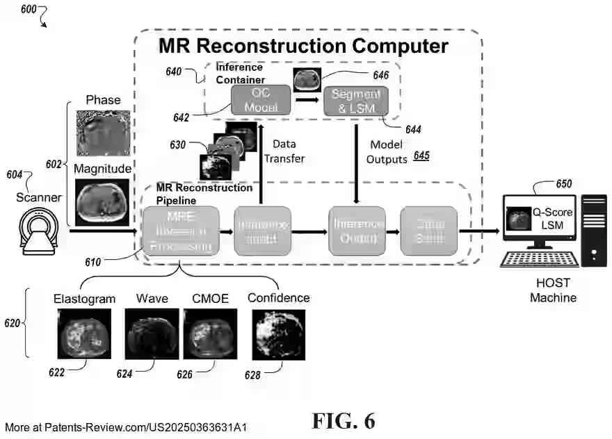 PatentPulse's tweet image. 🔍 New patent application #US20250363631A1 by #IcahnSchoolOfMedicine reveals a #DeepLearning-based system for enhancing #MagneticResonanceElastography (MRE) data acquisition. 
  
This innovation aims to automate quality control and stiffness measurements, minimizing…