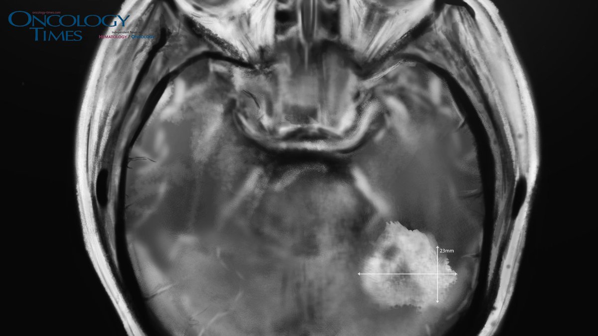 Oncology Times tweet media