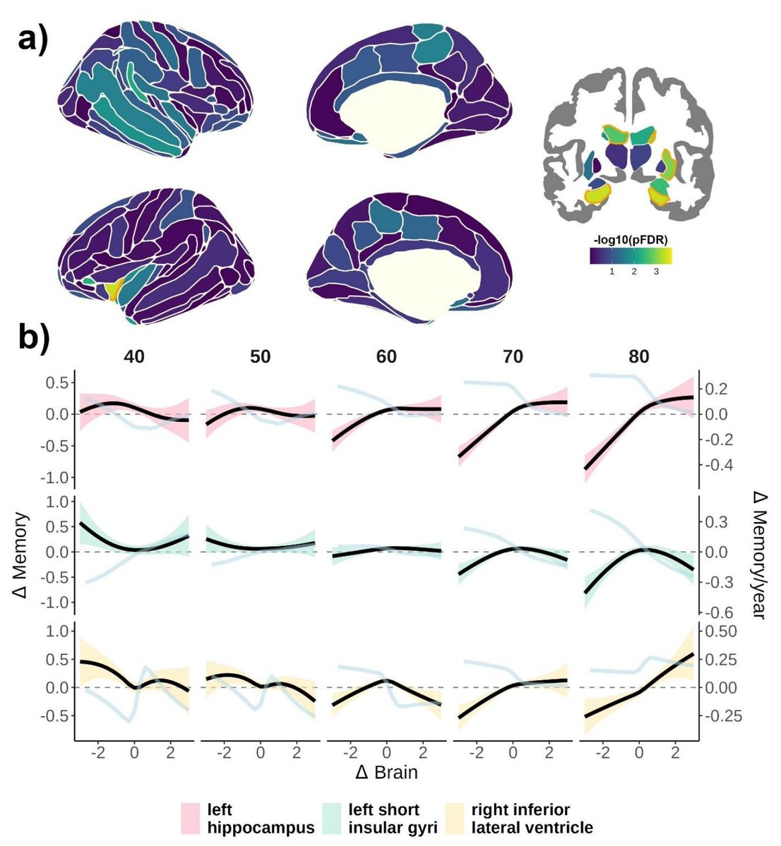 Very impressed with <a href="/VidalDidac/">Didac Vidal Pineiro</a>'s work in <a href="/NatureComms/">Nature Communications</a>, the most thorough mapping of longitudinal memory-atrophy relationships in aging, showing global and memory-specific associations, growing stronger with age. Early access here: nature.com/articles/s4146… <a href="/LCBC_UiO/">LCBC - UiO</a> <a href="/LifebrainEU/">Lifebrain</a>