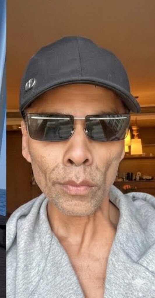 ये इंसान किस बीमारी से पीड़ित है?