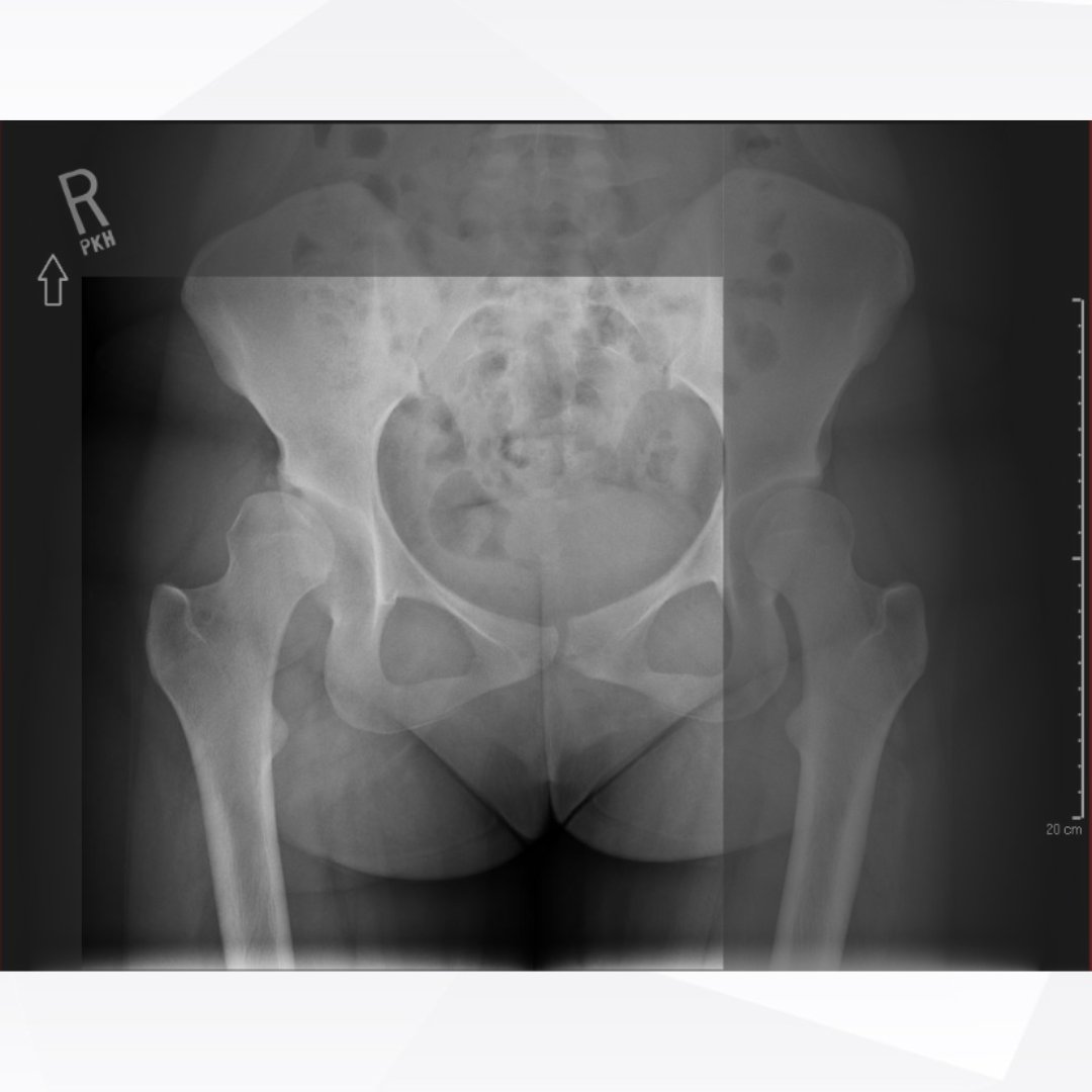 jbjs's tweet image. Do you know the correct answer? 

To reveal it, head over to the November Quiz of the Month: bit.ly/novqotm2025