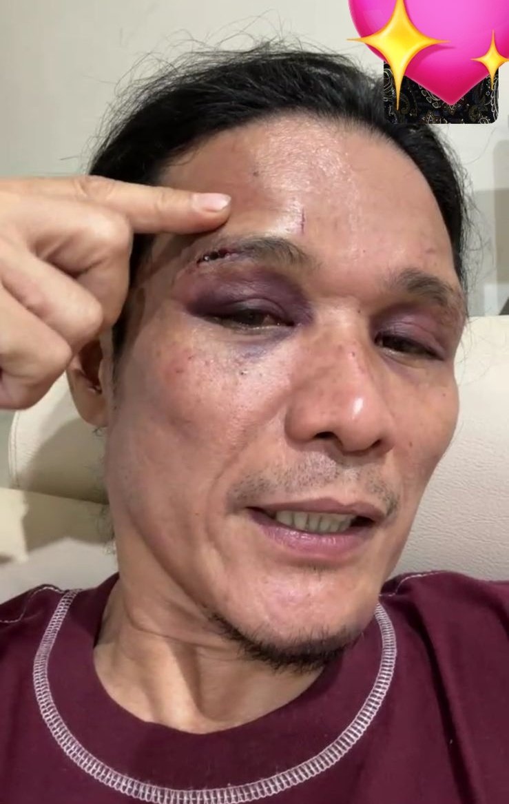 Astrosquerpants's tweet image. Bismillahirrohmanirrohim dengan menyebut nama ALLAH YANG MAHA KUASA🙏🏻🙏🏻

Sebulan tanpa keadilan untuk Aba ku.

‼️KEKERASAN &amp;amp; PEMBUNUHAN‼️

Kasus udah dilaporin sejak 19 Oktober, bukti &amp;amp; 21 saksi udah memberikan keterangan, tapi sampai hari ini gak ada kejelasan.
👇 Kronologi…