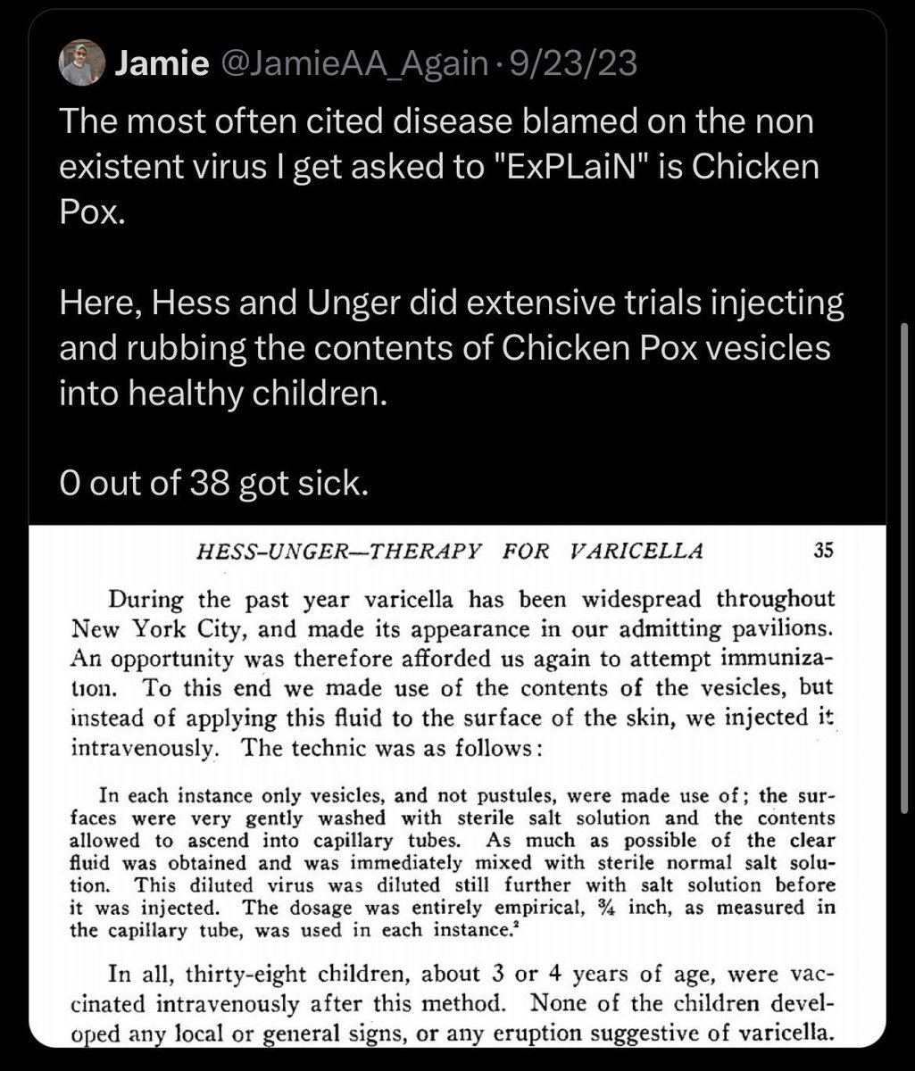 Burki677's tweet image. It gets to a point where they accidentally cite vaccination papers without realizing it. 🤣🤣🤣