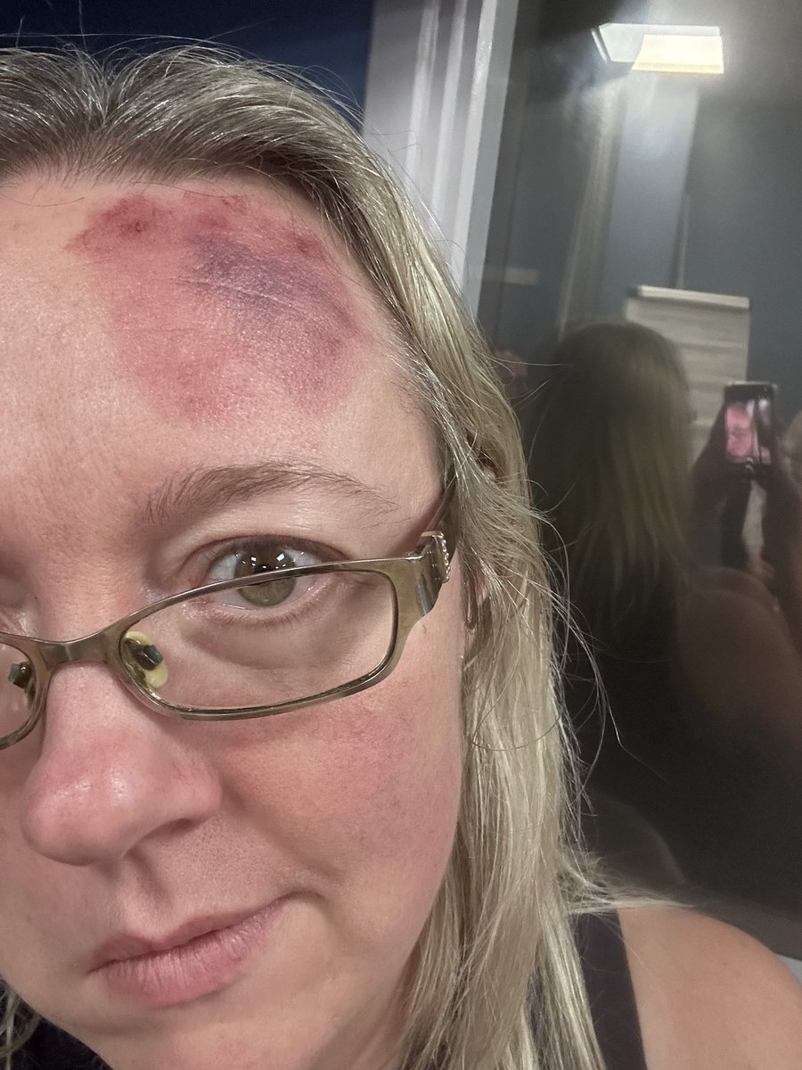 kerrylou85's tweet image. Fantastic 2 day Simulation Train the Trainers course at UBHW. Gotta love a bit of moulage!