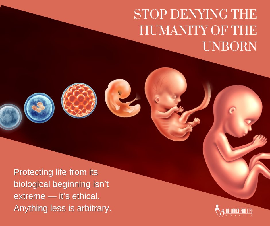 AFLO4Life's tweet photo. If human rights mean anything, they must begin at the biological beginning. Drawing lines at 12, 20, or 24 weeks is politics — not ethics. Every human life deserves protection.https://t.co/le4zzsRywW https://t.co/mZRwnxucZR