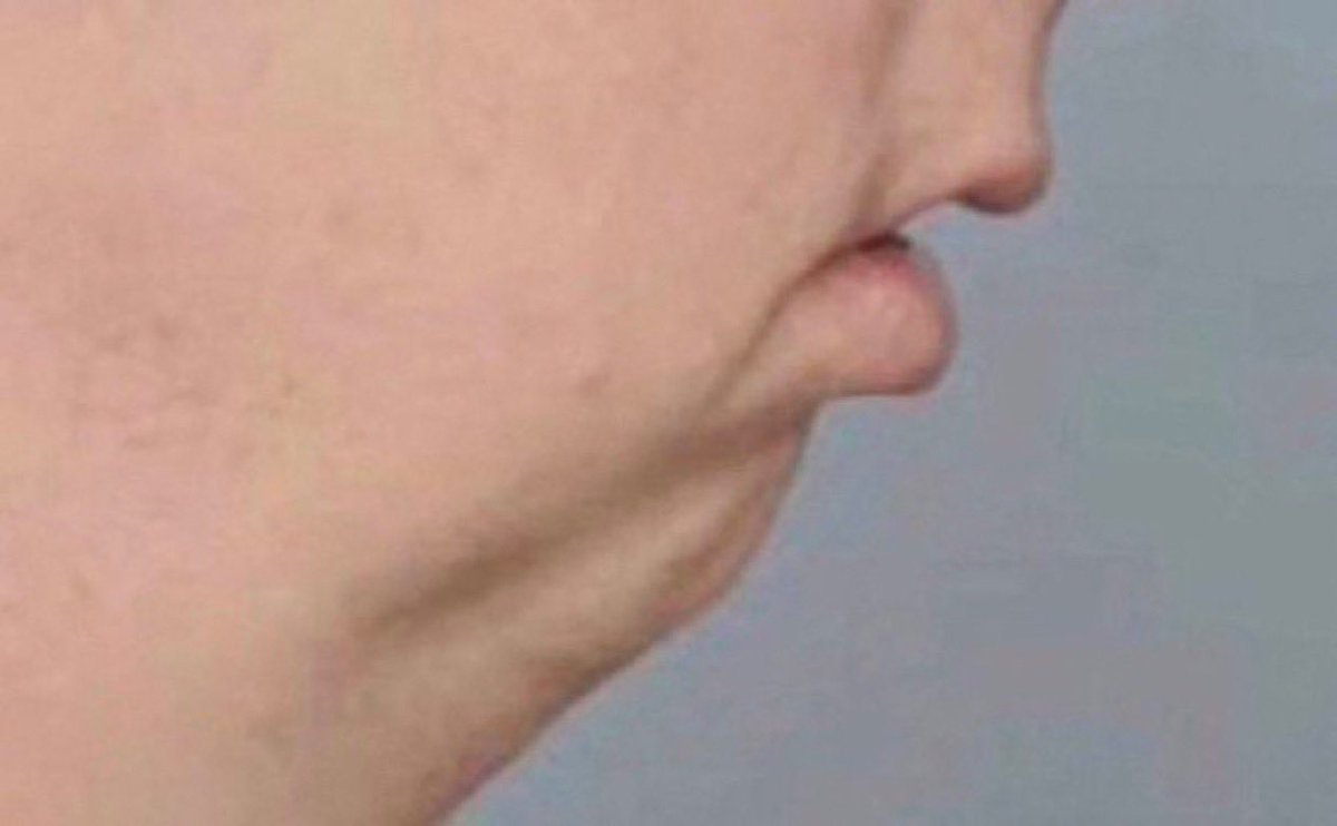 reminder everyday to be thankful you weren't born like this