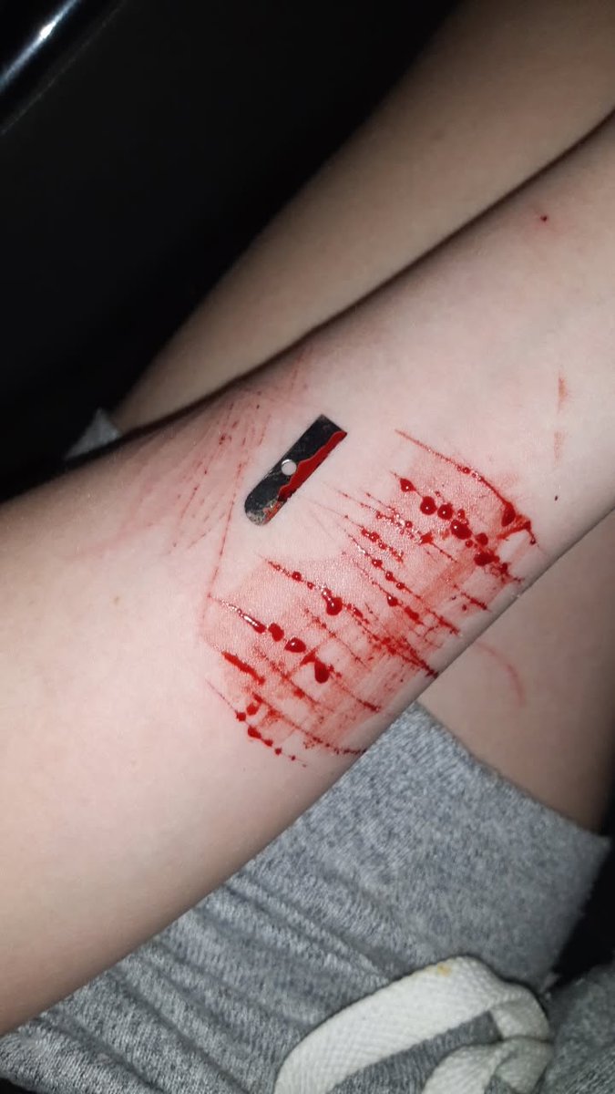 nameless00811's tweet photo. Sightly deep but yk lmao (car crashout) #selfharms #TRIGGERWARNING https://t.co/O9EmyyYMjo