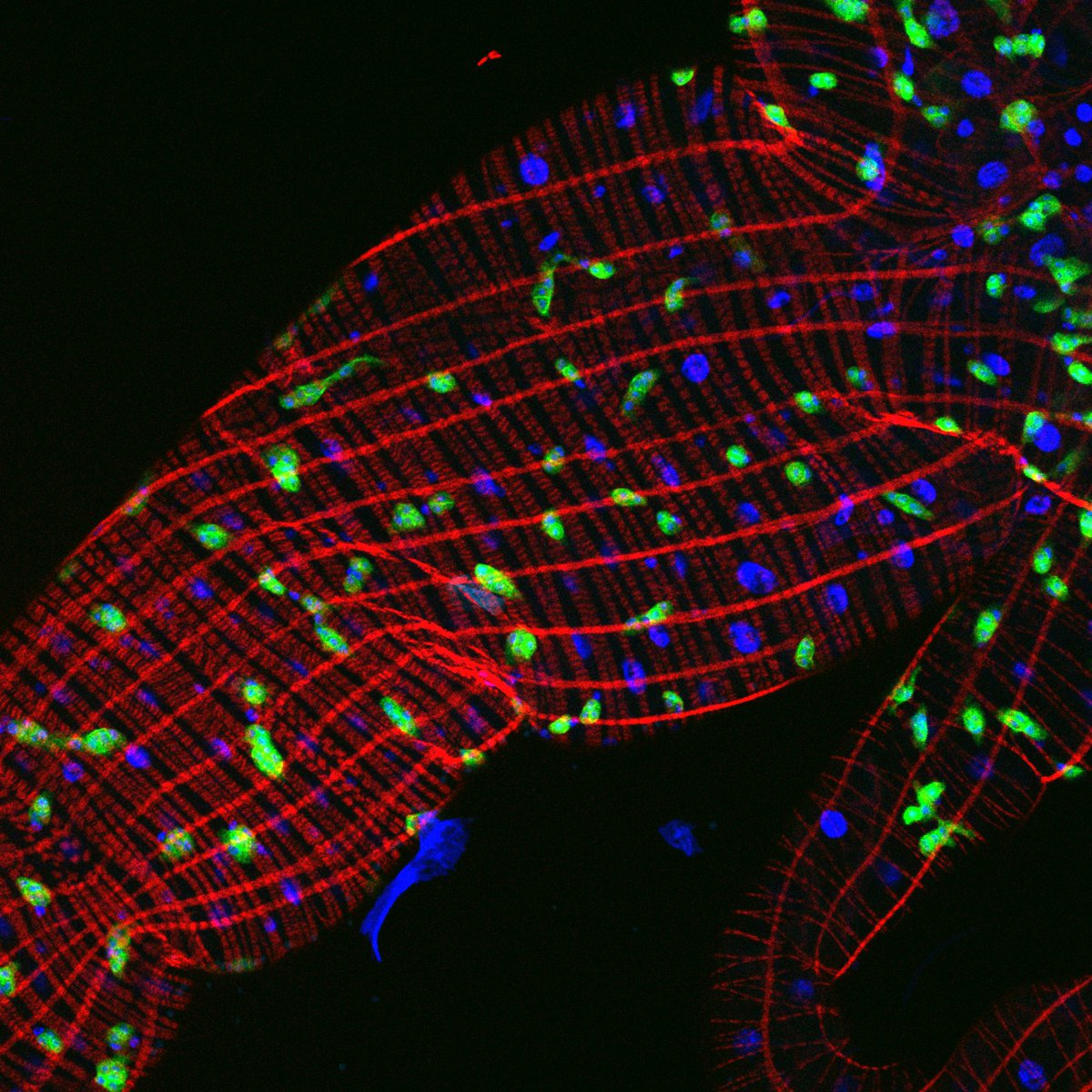 SocDevBio's tweet image. ✨A gut feeling you’ll love this one 🐛 The anterior midgut of a Drosophila melanogaster 🪰larva puts on a confocal glow show! 🟢 Adult midgut progenitors 🔴 Actin 🔵 Nuclei 📸Image by Sapna Krishnakumar #FluorescenceFriday #Microscopy #DevBio