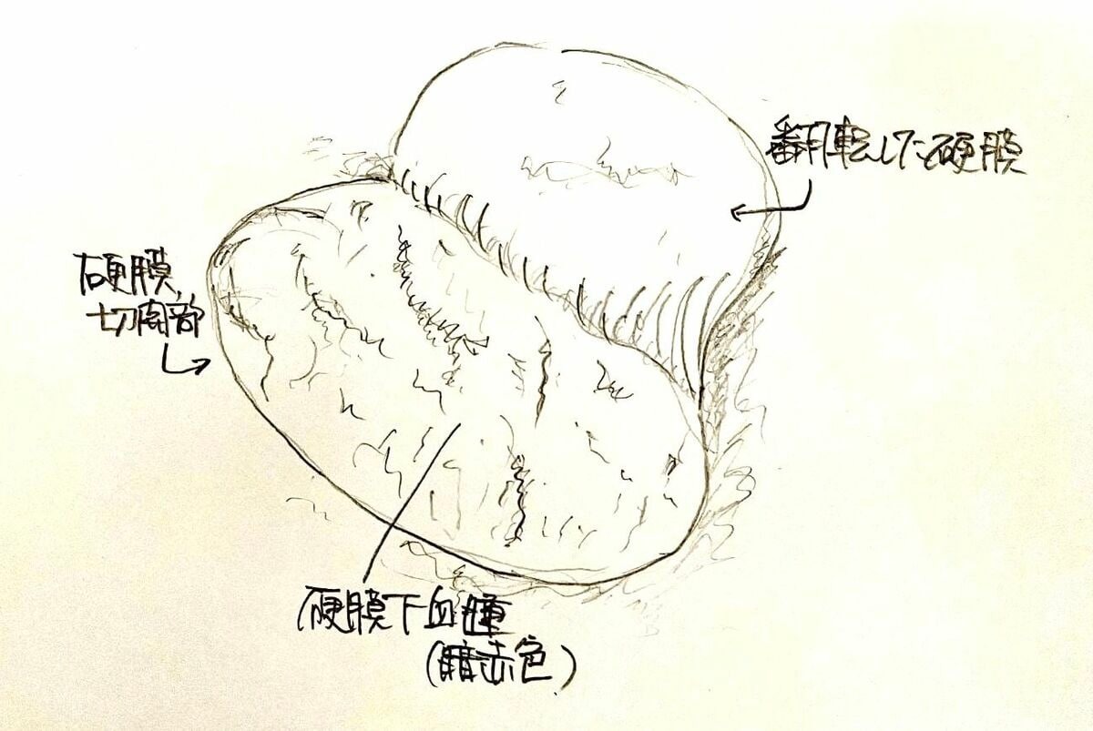 【裁判がおかしい】
飲酒逆走運転で娘奪われた母の怒り「血が写った写真は証拠採用されず」そして犯人に驚きの軽い刑《柳原 三佳》
ドラレコや防犯カメラ映像も「刺激的過ぎる」と証拠採用されないことも、こんな裁判員裁判で真実究明ができるのか