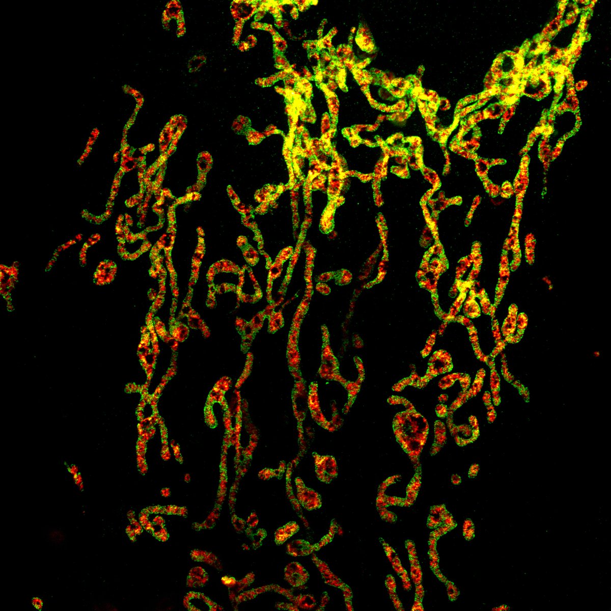 stephan_till's tweet image. Our  M. Sc. students had their first encounter with STED microscopy this week — and  captured some stunning  super-resolution images🔬