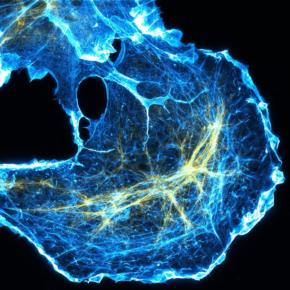 stephan_till's tweet image. Our  M. Sc. students had their first encounter with STED microscopy this week — and  captured some stunning  super-resolution images🔬