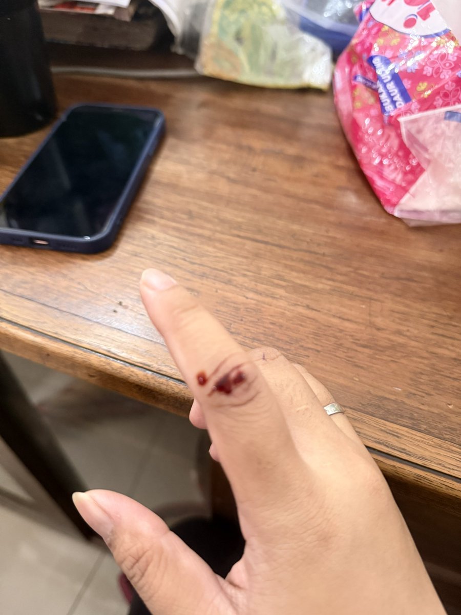 Randess's tweet photo. Hari hari berdarah🙃☺️🙃 https://t.co/1vmez3oTcl