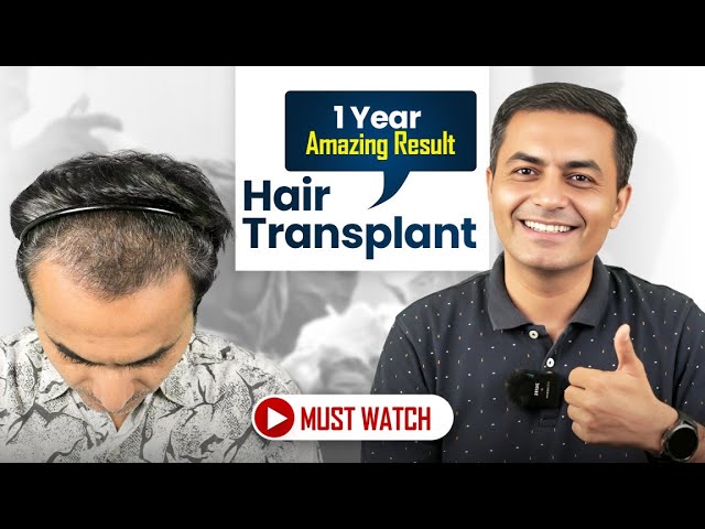 Hairfree and Hairgrow - Hair Transplant Clinic tweet media