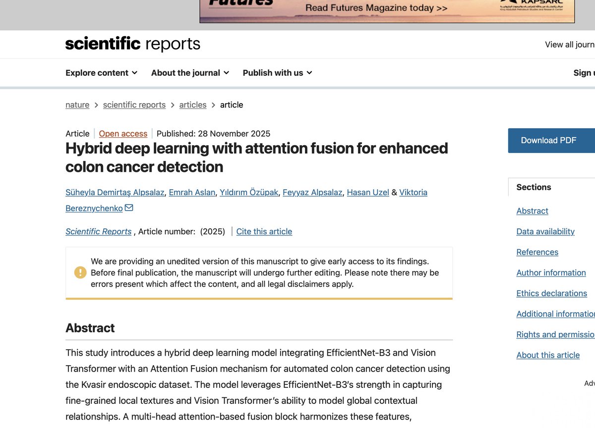 rocknews8964's tweet image. New paper in Scientific Reports uses a hybrid EfficientNet+ViT model with attention fusion to reach 96.2% accuracy in colon cancer detection from endoscopy images. Smarter screening, fewer missed tumors. 🧠🩺 #AI #MedTech 

nature.com/articles/s4159…