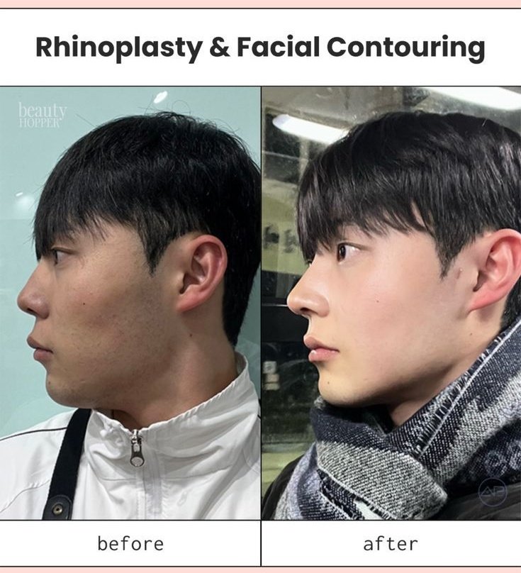 That handsome oppa you see in K-dramas