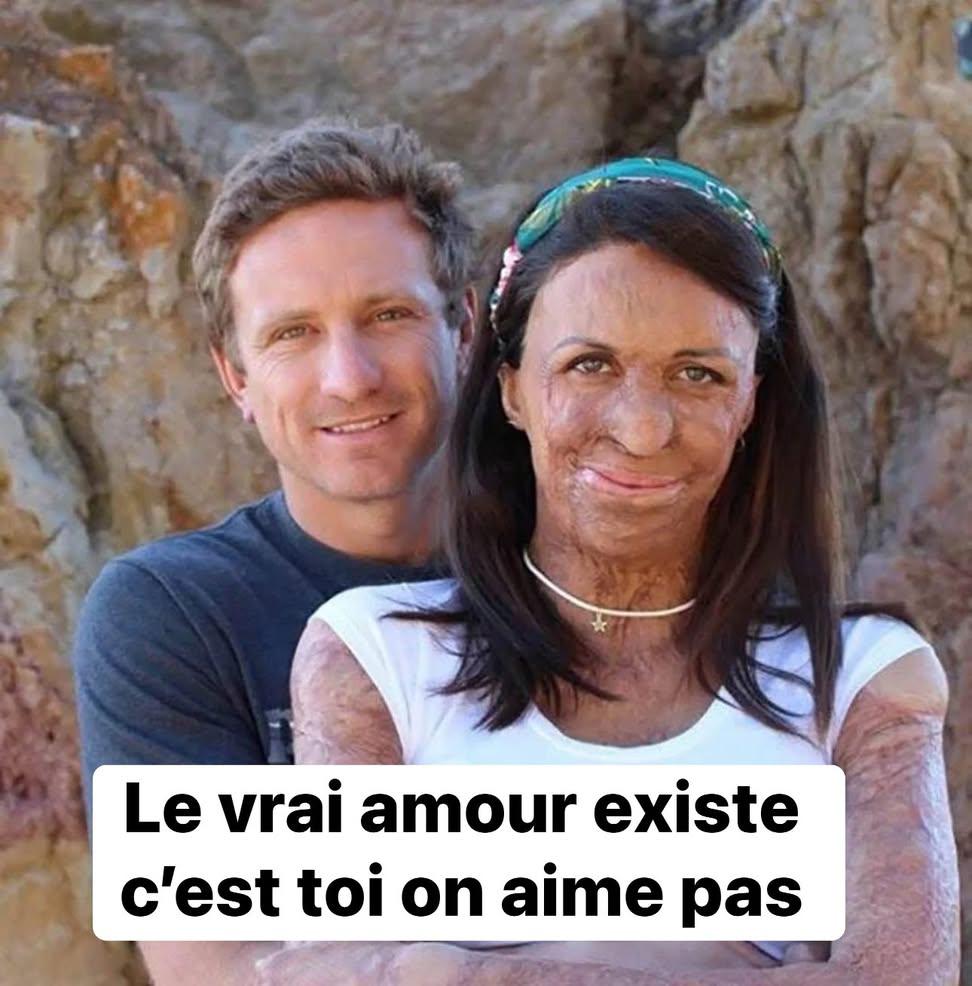 Hazelkeech0918's tweet image. Unwavering devotion! ❤️😲 After a fire altered his wife&apos;s beauty, her husband refused to abandon her. 💪🙌
Despite the changes in her appearance, he never wavered in his love or commitment. 👩‍❤️‍👨💍