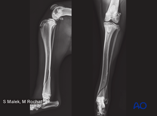 AO Surgery Reference tweet media