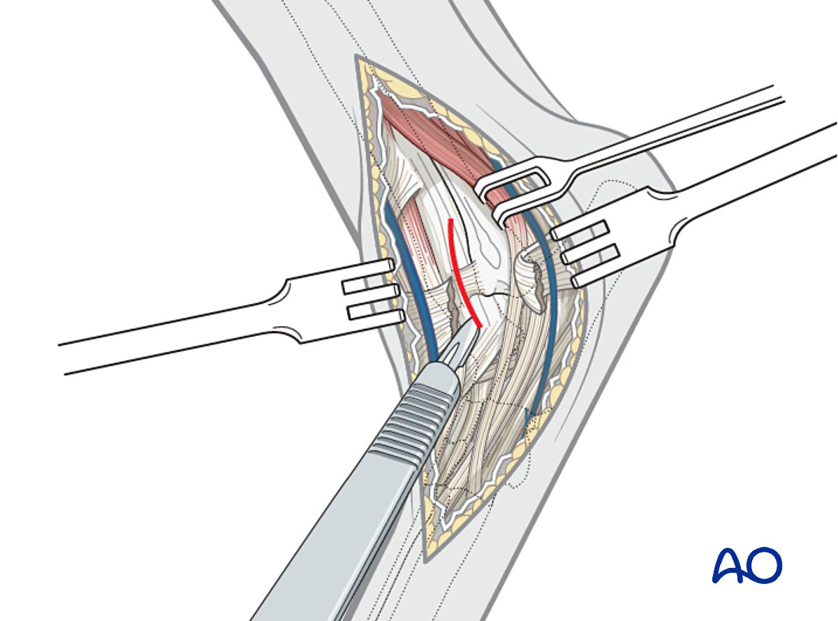 AO Surgery Reference tweet media