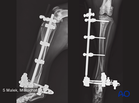 AO Surgery Reference tweet media