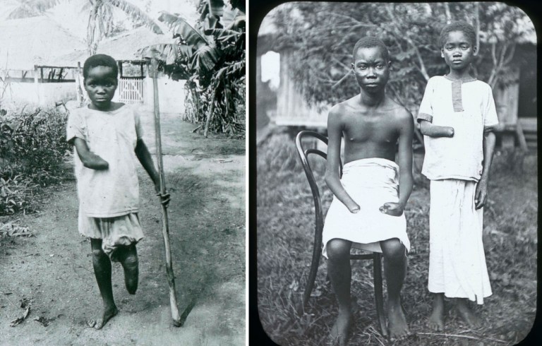 Belgians chopped the hands of Congolese for failing to meet rubber collection quotas.