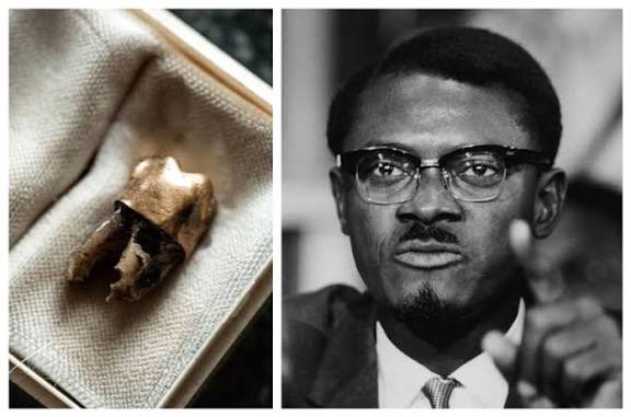 They (the CIA &amp; Belgium) killed Lumumba, dismembered him and and dissolved his body in acid.

Only his golden teeth remained, Belgium decided to expose it in a Brussels Museum, as a warning against any African who would dare liberate his country.

Today Congo is still controlled