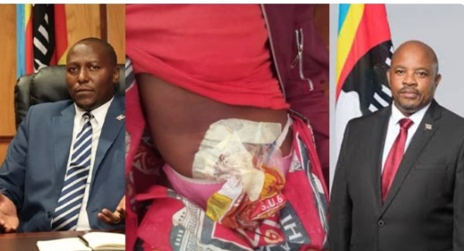 When 46-year-old road accident survivor Mkhulisi Masina* wheels himself across the small bedroom he now rarely leaves, his greatest fear is not pain or paralysis—it is the soundless leak that signals his colostomy bag has failed again.
inhlase.com/lives-in-limbo…