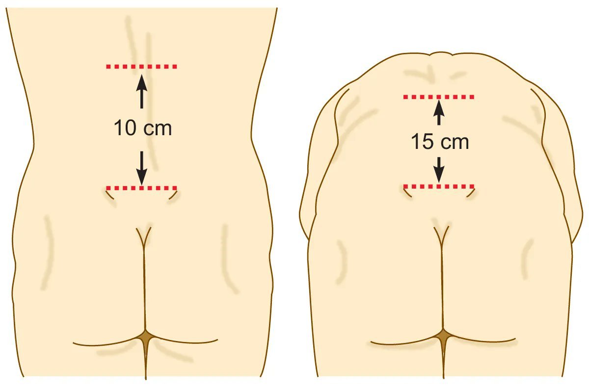 DrAkhilX's tweet image. What is this medical test?