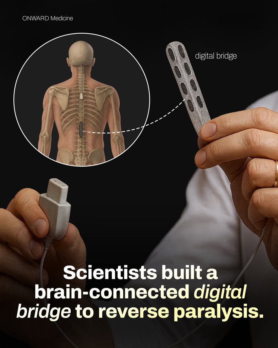 ShiningScience's tweet image. Scientists have developed a groundbreaking digital bridge that connects the brain directly to the spinal cord. According to ONWARD Medicine, this technology captures brain signals and transmits them past damaged nerve pathways. By bypassing spinal injuries, the device restores…