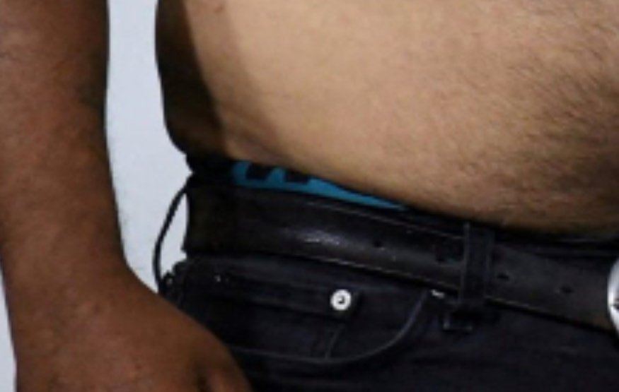 Nos quieren hacer creer que a ese gordo mugroso al que se le ven los calzones en público se le pegan cosas en la piel por las vacunas y no por mugriento