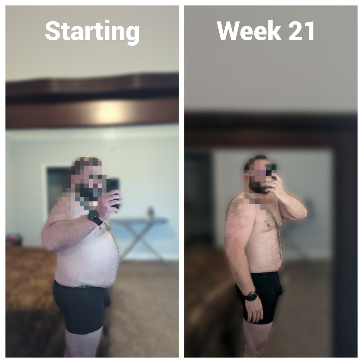 RetatrutideLog's tweet image. Week 21 Progress 📈
SW: 336.6 lbs 
CW: 264.4 lbs 
This week: +2.2 lbs 
Total: -72.2 lbs

Added Carbs, scale went up (glycogen). Not panicking. Data over emotion.

New: Added video summaries to the log 

Week 21 post: retatrutidelog.com/posts/retatrut…

#Retatrutide #WeightLoss #Biohacking