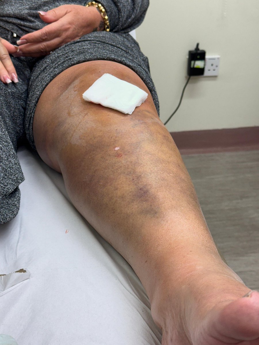 Mr Lumpy & Friends tweet media