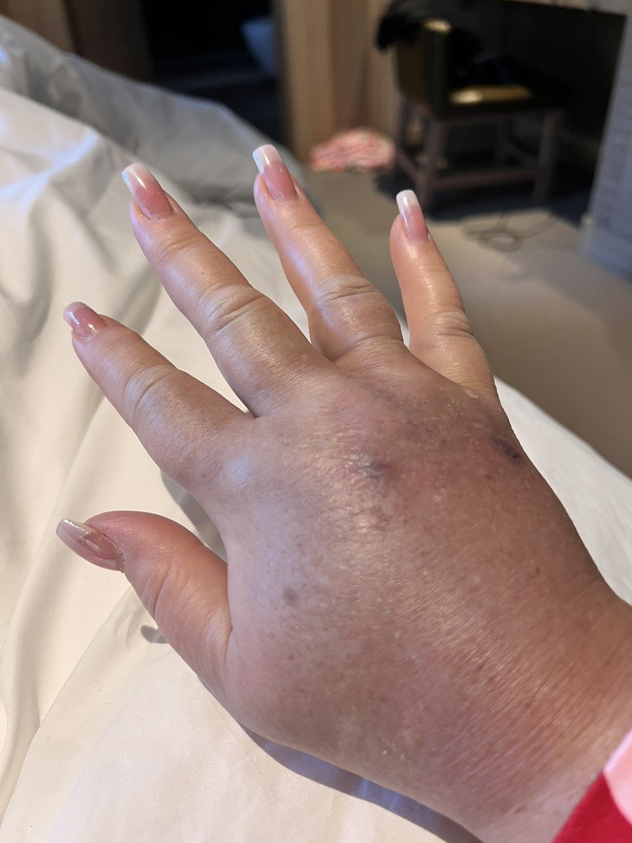 Mr Lumpy & Friends tweet media