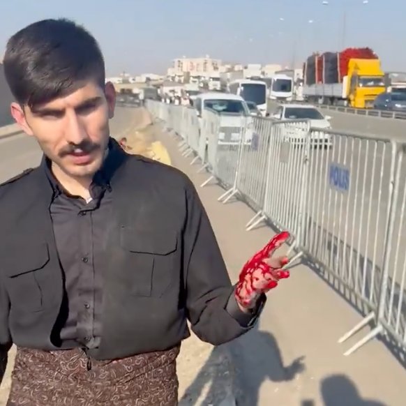 Sopakurd's tweet photo. Cizre’de yaşanan görüntüler hepimizi derinden üzmüştür.
Kürdistan bayrağına tahamülsüzlük ve   uzanan her müdahale, aslında halkların birbirini anlaması gerektiğini bir kez daha hatırlatmaktadır.

Bu mesele ne bir kavganın ne de ayrışmanın konusu olmalıdır.
Kürt halkının renkleri, kültürü ve sembolleri; bu coğrafyanın ortak zenginliğidir.
Hiçbir halkın onuru incinmesin, hiçbir gencin kalbi kırılmasın.

Bizler, tarihin acılarından değil; birlik, saygı ve karşılıklı anlayıştan güç almayı seçiyoruz.
Dileğimiz odur ki herkes, kimliğini ve değerlerini özgürce ifade edebilsin ve bu topraklarda barışın sesi her zaman daha güçlü çıksın. Ayrıca yapılan gözaltının ifade alındıktan sonra serbest bırakılmasını temnni edîyoruz ve Kürdistan bayrağına yapılan tahamülsüzlüğü reddediyoruz ...

#aliçevennebitenêye
#aliçevenyalnızdeğildir