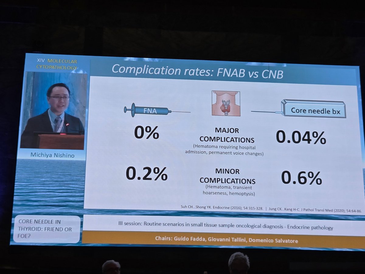 Excellent overview of CNB as "friend with limitations"  in #thyroid presented by <a href="/MichiyaNishino/">Michiya Nishino, MD, PhD</a> #MolCytoPath25