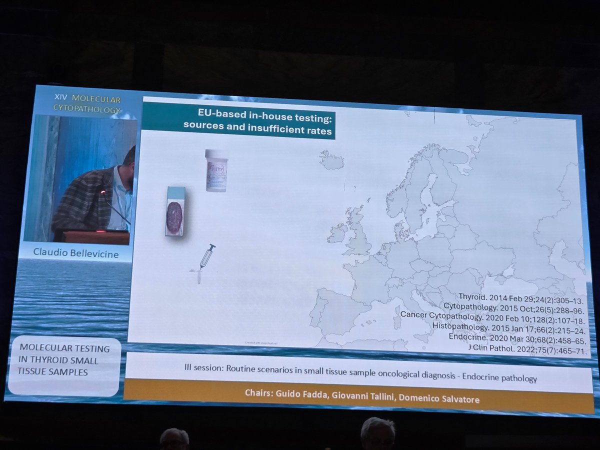Expert views on #thyroid molecular #cytopath #MolCytoPath25 given by Prof. Bellevicine <a href="/pathologyfinder/">Claudio Bellevicine</a>