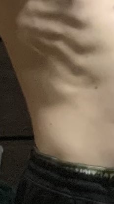 BoundGrey's tweet image. У меня ребра все еще  как у чуваков на оземпике или РПП