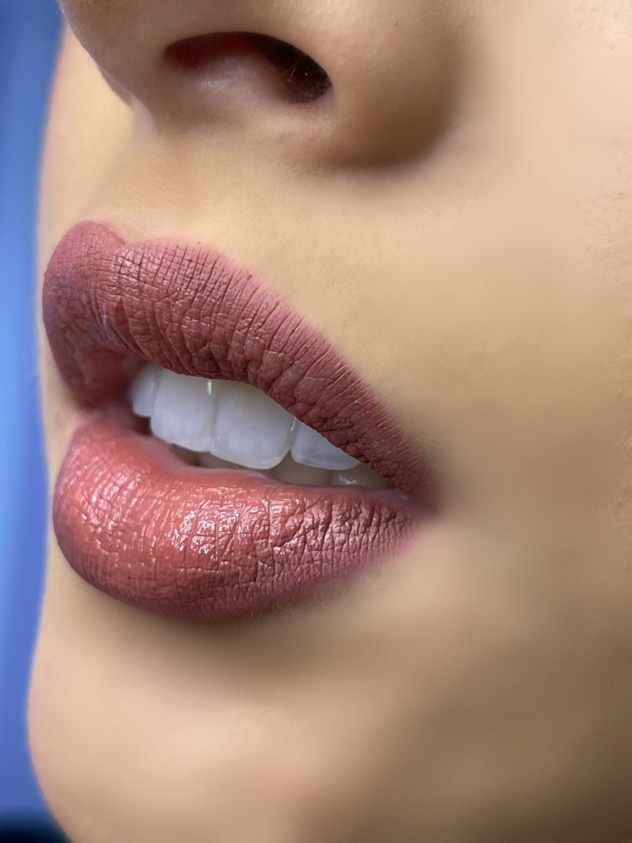 dranatysanchez's tweet photo. I craft smiles for joyful moments 🤍 with passion, artistry, and purpose.
I’m Nataly Sánchez, a Colombian aesthetic dentist 🦷
I’m new here on X, and I’d love to have you with me on this journey. ✨
#veneers https://t.co/EMnaQ0JfC8