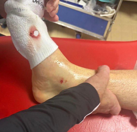 ActuFoot_'s tweet image. 🦵🩸 LA CHEVILLE DE LUCAS CHEVALIER 🇫🇷 À LA MI-TEMPS APRÈS LA GROSSE SEMELLE DE CAMARA 🇸🇳 !

📸 @ArthurPerrot @RMCsport