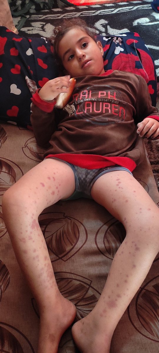 donea265822's tweet image. I&apos;m pleading with you again My sick child needs medication and hospital expenses Please kind people I don&apos;t want to lose my child She suffers all night and my heart is breaking for her😭😭
chuffed.org/project/153931…