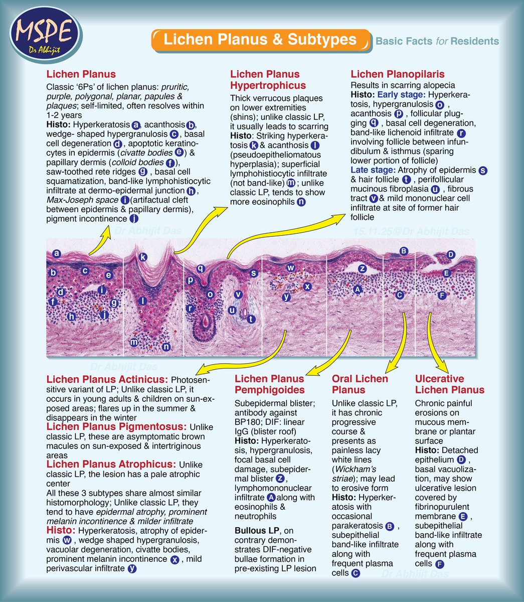Lichen Planus
Basic facts for residents 

#MakeSurgiPathEasy
#MakeDermaPathEasy