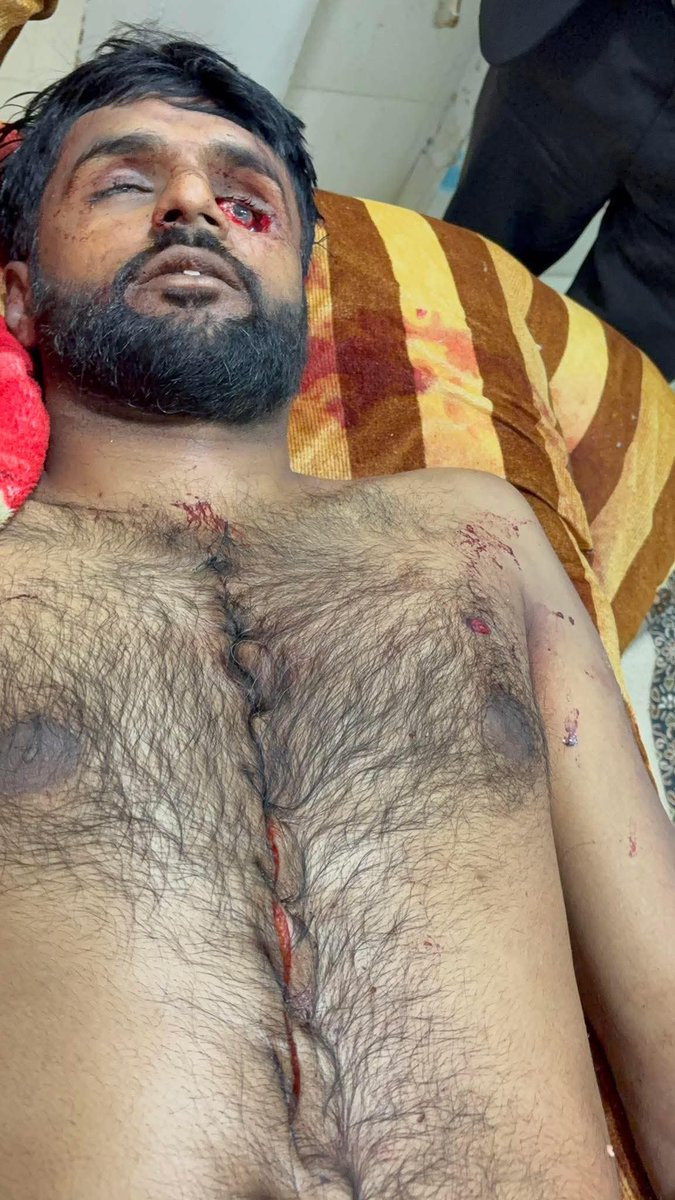 اگر فیصلہ پولیس نے ہی کرنا ہے تو پھر عدالتوں کا ڈھانچہ، جج صاحبان، عملہ اور اربوں روپے کا بجٹ کس خوشی میں چلایا جا رہا ہے؟ عوام کے ٹیکس کے پیسے سے عدالتیں بنائیں، اور انصاف گولی سے کرایا جا رہا ہے تو پھر بہتر ہے ان عدالتوں کو تالا لگا کر قوم کو سچ بتا دیں کہ فیصلہ وردی کرے گی،.