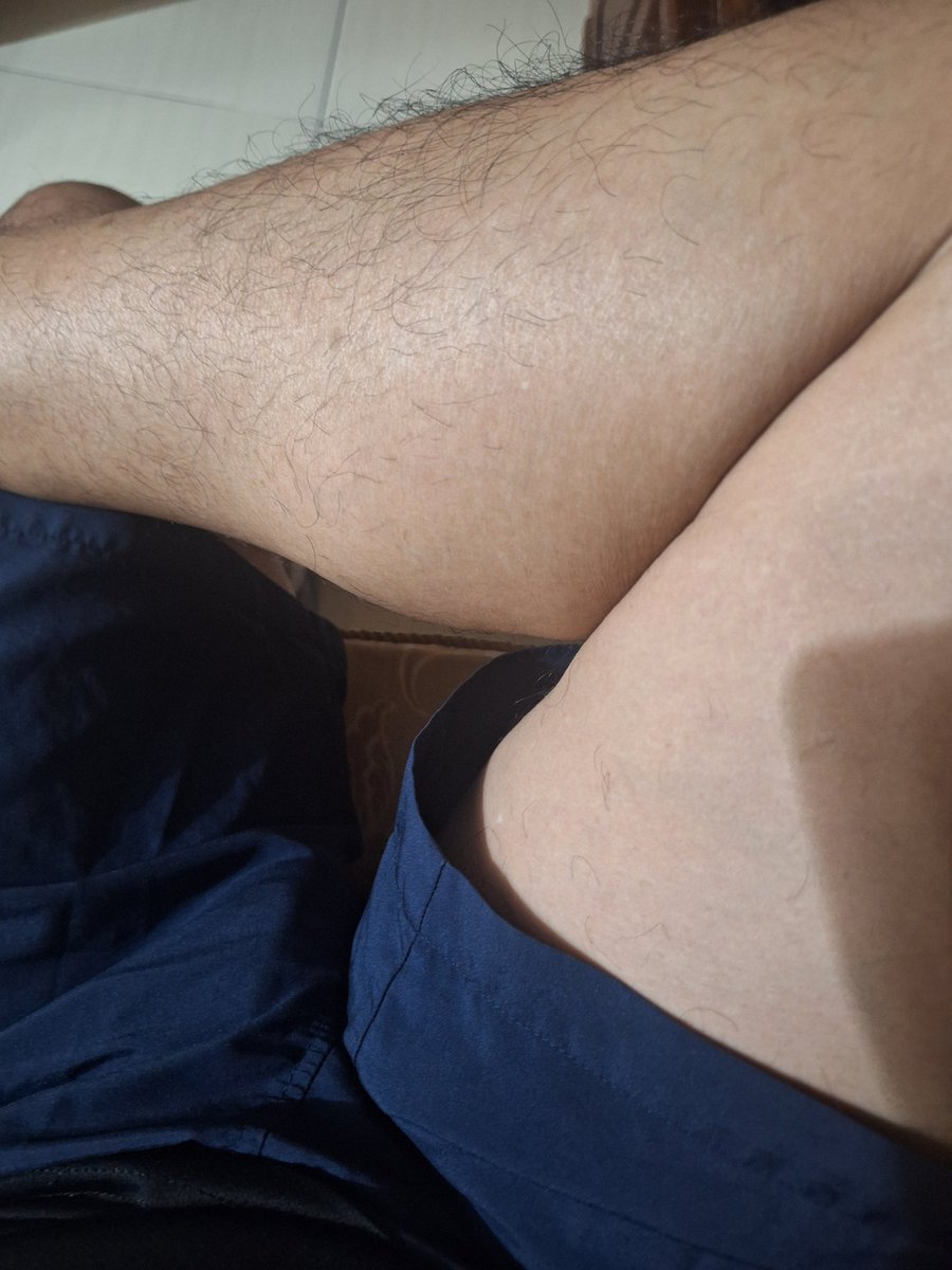 全身上下都是毛