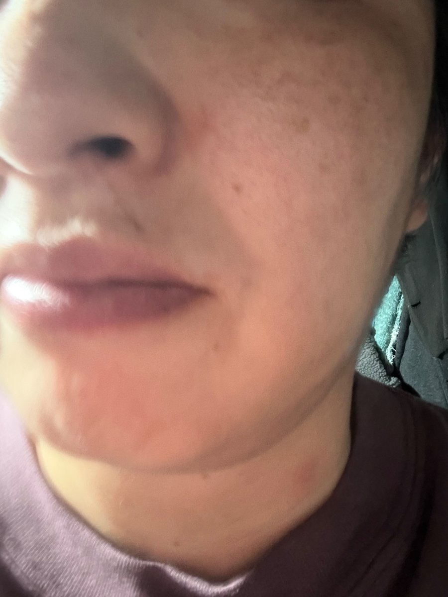 na11032000's tweet image. KC-SKINモイストエイジケアセラム&amp;amp;モイストエイジケアセラムマスクピンクを試してみました。
保湿がしっかりできていいです。クリームの伸びがいいです。

#モイストエンジケア
#KC-SKIN
#モイストエンジケアセラム
#美容液 
#PR