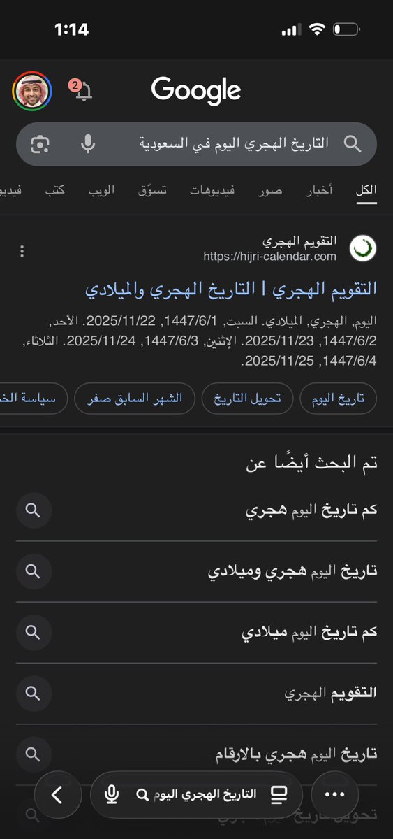 YousefAlsharedh's tweet image. معلومة غريبة علي أنا يمكن الناس تعرفها وانا اول مرة اعرفها!!

اشتريت زبادي قبل شهر تقريباً، صحن كامل ٦ حبات

نسيتها في الثلاجة و اشتريت مرة ثانية بعدها

استهلكنا الكمية الجديدة و مازالت القديمة بالثلاجة

قبل شوي أخذت علبة مكتوب تاريخ الانتهاء ١٢ نوفمبر ٢٠٢٥

فتحت العلبة لقيتها ما…