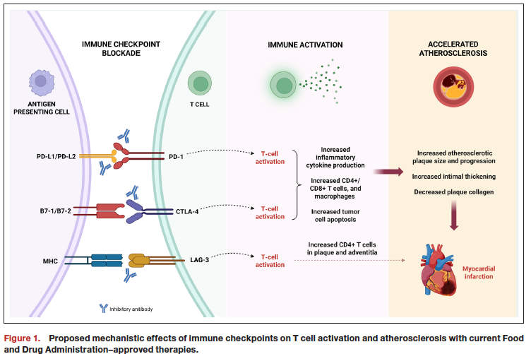 datsunian's tweet image. Fantastic #cardioonc review led by @DOM_UCLA IM res #rachelsaganty on mechanisms of ICI &amp;amp; ACS in @JAHA_AHA issue on the intersection of inflammation @ CVD

As ICI use 🚀 in cancer, we 🔎mechanisms of its impact on ASCVD &amp;amp; cancer survivorship. #bruinhearts

ahajournals.org/doi/10.1161/JA…